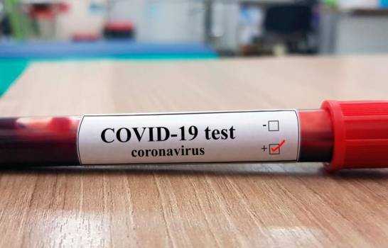 test de coronavirus 13531952 20200325214644