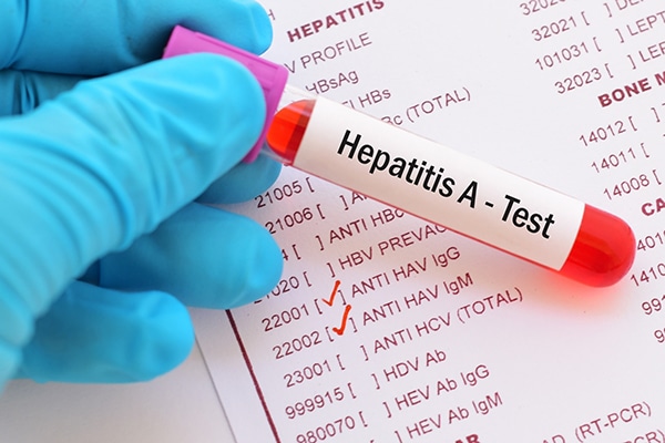 CinfaSalud imagen hepatitis a 600