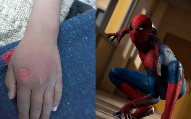 Nino termina en el hospital tras dejarse picar por arana para convertirse en Spider Man